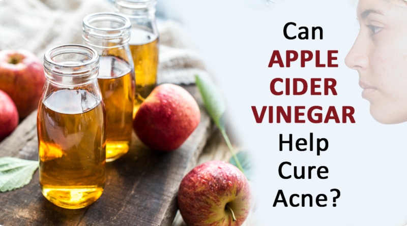 CAN APPLE CIDER VINEGAR HELP CURE ACNE?